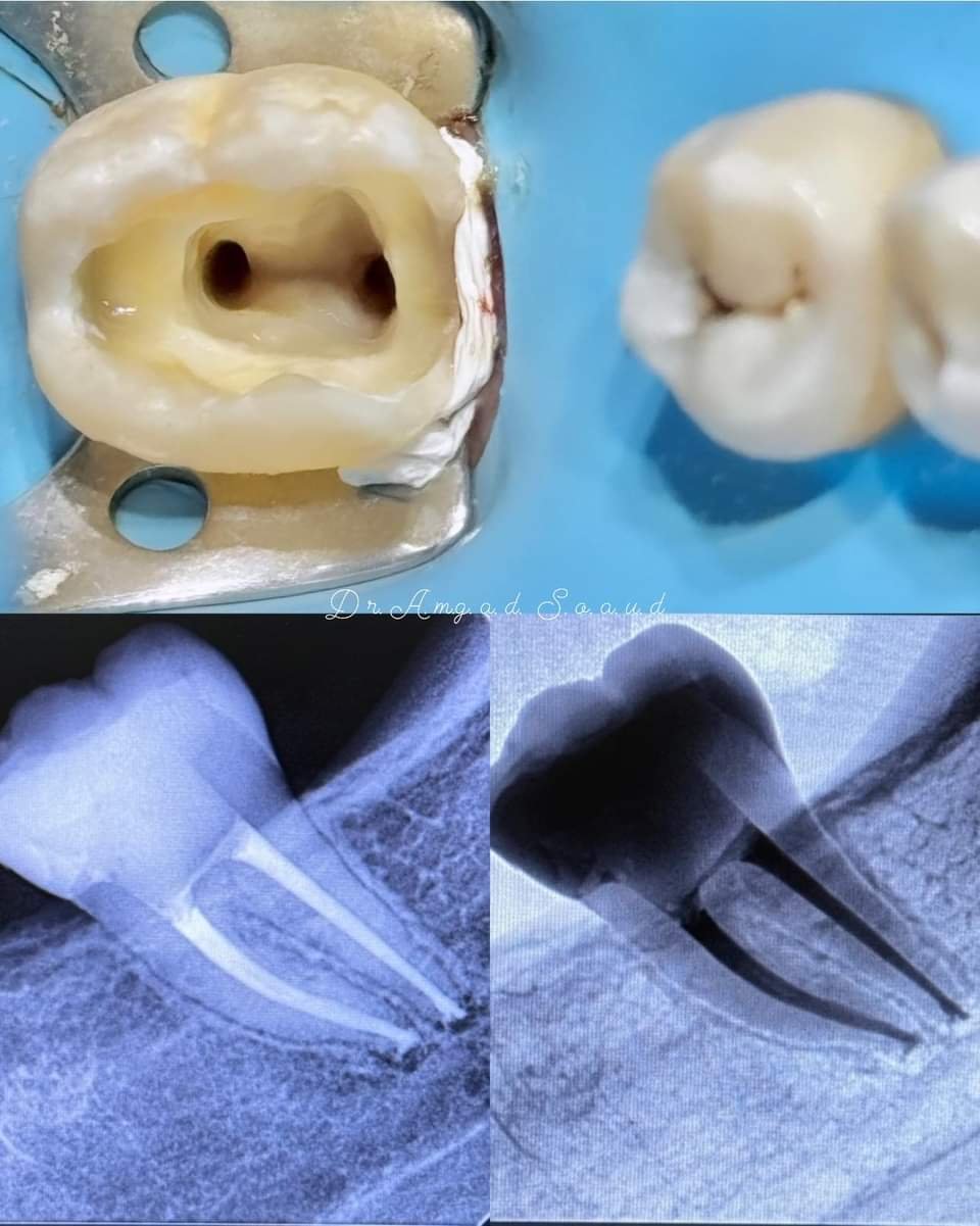 DU d'Endodontie